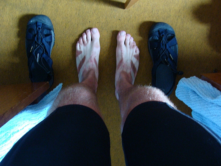 Tijgervoeten! Bij-effekt van mijn sandalen: de zon heeft leuke streeppatronen op mijn voeten gebrand